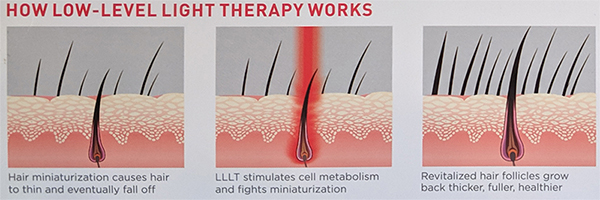 how does lllt work