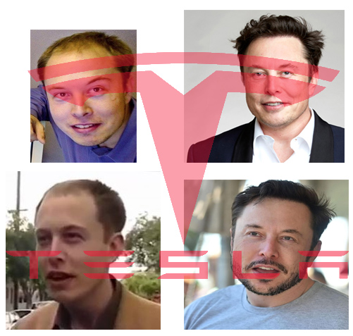Elon Musk Hair Loss, Shocking Change, How did he do it?