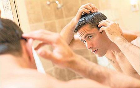 Hair Loss Treatment and Products